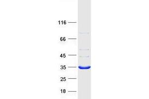 Validation with Western Blot