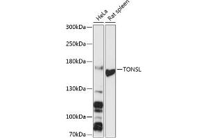 Western blot analysis of extracts of various cell lines, using TONSL antibody (ABIN6132818, ABIN6149388, ABIN6149389 and ABIN6216872) at 1:3000 dilution. (NFKBIL2 anticorps  (AA 160-390))