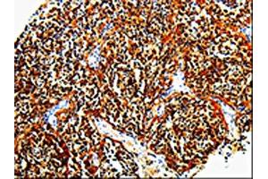 The image is immunohistochemistry of paraffin-embedded Human tonsil tissue using ABIN7131379(TLR7 Antibody) at dilution 1/10. (TLR7 anticorps)