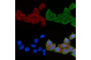 ABIN6258910 and ABIN6275186 staining Hela cells(30 min of UV treatment) by IF/ICC. (HLA-DOA anticorps)