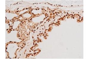 ABIN6267523 at 1/200 staining Rat lung tissue sections by IHC-P.