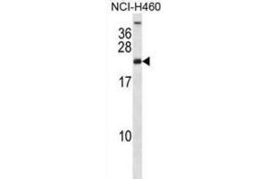 Western Blotting (WB) image for anti-Ribosomal Protein S16 (RPS16) antibody (ABIN2998333) (RPS16 anticorps)