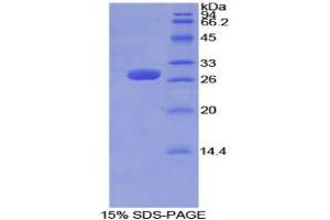 SDS-PAGE analysis of Mouse Tubulin delta Protein. (TUBD1 Protéine)
