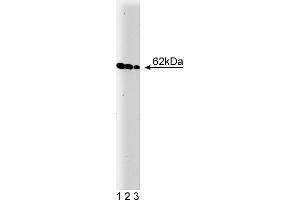Western Blotting (WB) image for anti-V-Yes-1 Yamaguchi Sarcoma Viral Oncogene Homolog 1 (YES1) (AA 10-193) antibody (ABIN967927) (YES1 anticorps  (AA 10-193))