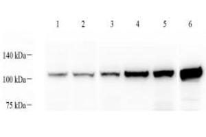 Western blot analysis of alpha Actinin (ABIN7073023) at dilution of 1: 1000,Lane 1: MCF7 cell lysate,Lane 2: Hela cell lysate,Lane 3: Mouse spleen tissue lysate,Lane 4: Mouse skeletal muscle tissue lysate,Lane 5: Mouse heart tissue lysate,Lane 6: Rat skeletal muscle tissue lysate (alpha Actinin anticorps)