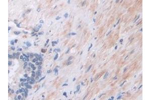 Detection of PIK3Cb in Human Prostate Tissue using Polyclonal Antibody to Phosphoinositide-3-Kinase Catalytic Beta Polypeptide (PIK3Cb)