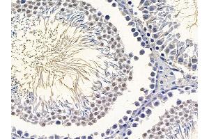 ABIN6265350 and ABIN6266871 at 1/100 staining rat testis tissue by IHC-P. (STRADA anticorps  (Internal Region))