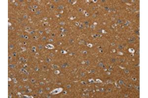 The image on the left is immunohistochemistry of paraffin-embedded Human brain tissue using ABIN7191878(PIK3CD Antibody) at dilution 1/20, on the right is treated with synthetic peptide. (PIK3CD anticorps)
