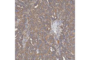 IHC analysis of SEC31A using anti-SEC31A antibody (ABIN7599630).
