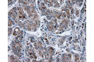 Image no. 7 for anti-Lipase, Endothelial (LIPG) antibody (ABIN1499163) (LIPG anticorps)