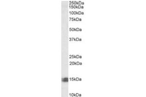 Image no. 1 for anti-Caspase Recruitment Domain Family, Member 17 (CARD17) (C-Term) antibody (ABIN487981) (CARD17 anticorps  (C-Term))