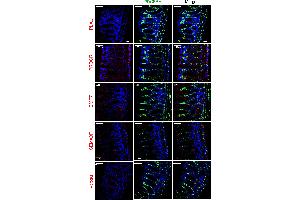 Non-selective expression of PCSK6 in colonic MuPαC.