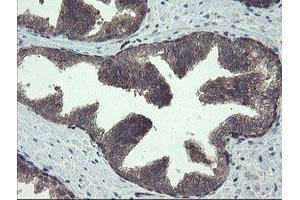 anti-TSC22 Domain Family, Member 1 (TSC22D1) antibody