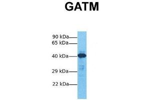 Host:  Rabbit  Target Name:  GATM  Sample Tissue:  Human Fetal Liver  Antibody Dilution:  1.