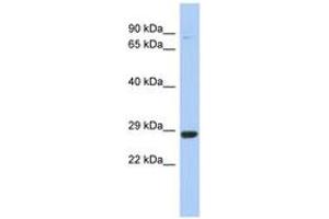 Image no. 1 for anti-Chromosome 21 Open Reading Frame 91 (C21orf91) (AA 71-120) antibody (ABIN6743397) (C21orf91 anticorps  (AA 71-120))