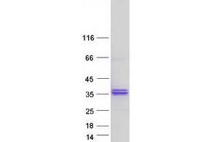 Validation with Western Blot