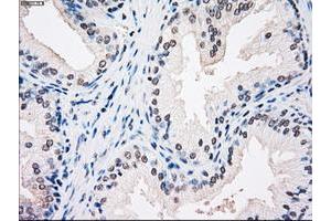 Image no. 1 for anti-Sjogren Syndrome Antigen B (SSB) antibody (ABIN1501143) (SSB anticorps)