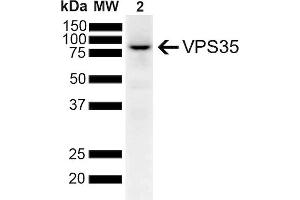 Western Blot analysis of Human SH-SY5Y lysates showing detection of 91. (VPS35 anticorps  (Atto 594))