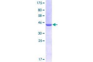 Image no. 1 for Netrin receptor UNC5B (UNC5B) (AA 27-126) protein (GST tag) (ABIN1324652)