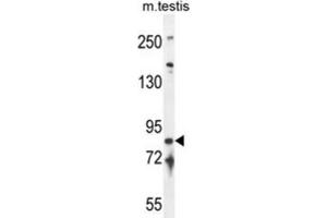 Western Blotting (WB) image for anti-Intraflagellar Transport 81 Homolog (IFT81) antibody (ABIN2995688) (IFT81 anticorps)