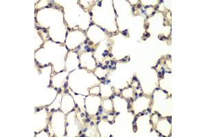 Immunohistochemistry of paraffin-embedded mouse lung using MAPK14 antibody (ABIN5998182) at dilution of 1/100 (40x lens). (MAPK14 anticorps)