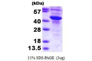 Figure annotation denotes ug of protein loaded and % gel used.