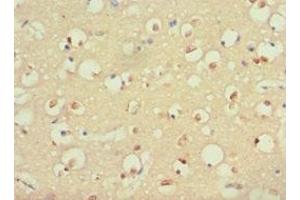 Immunohistochemistry of paraffin-embedded human brain tissue using ABIN7166082 at dilution of 1:100 (S100B anticorps  (AA 1-92))