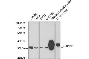 Western blot analysis of extracts of various cell lines using TPM2 Polyclonal Antibody at dilution of 1:400. (TPM2 anticorps)