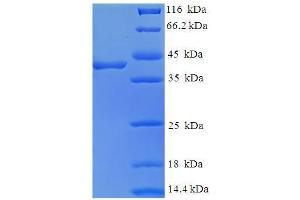 SDS-PAGE (SDS) image for FK506 Binding Protein 3, 25kDa (FKBP3) (AA 2-224) protein (His-SUMO Tag) (ABIN5709529) (FKBP3 Protein (AA 2-224) (His-SUMO Tag))