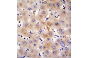 Immunohistochemistry analysis in formalin fixed and paraffin embedded human liver tissue reacted with FBXO47 Antibody (N-term) followed by peroxidase conjugation of the secondary antibody and DAB staining. (FBXO47 anticorps  (N-Term))