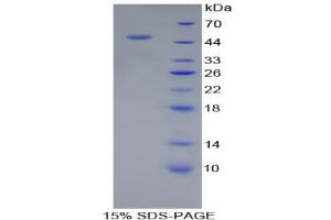 SDS-PAGE analysis of Human PSMC6 Protein. (PSMC6 Protéine)