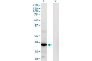 Western Blot analysis of RNASEH2C expression in transfected 293T cell line by RNASEH2C monoclonal antibody (M02), clone 5D6. (RNASEH2C anticorps  (AA 1-164))