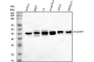 Western blot analysis of HnRNPF using anti-HnRNPF antibody (ABIN4886622). (HNRNPF anticorps  (N-Term))