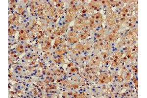 Immunohistochemistry of paraffin-embedded human adrenal gland tissue using ABIN7153422 at dilution of 1:100 (GALT anticorps  (AA 1-379))