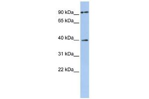 MAGEA6 antibody used at 1 ug/ml to detect target protein. (MAGEA6 anticorps  (Middle Region))