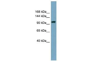 ELP2 antibody used at 1 ug/ml to detect target protein.