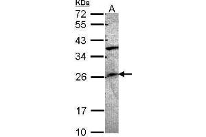 WB Image Sample (30 ug of whole cell lysate) A: A549 12% SDS PAGE antibody diluted at 1:1000