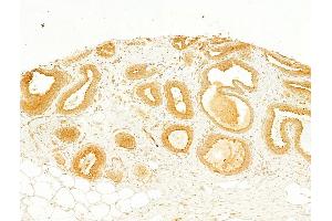 ABIN6260660 and ABIN6268685 at 1/100 staining Human normal tissues adjacent to breast cancer by IHC-P. (CD9 anticorps  (Internal Region))
