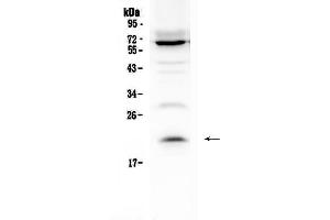 Western blot analysis of IL13 using anti-IL13 antibody . (IL-13 anticorps  (AA 36-146))