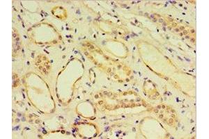 Immunohistochemistry of paraffin-embedded human kidney tissue using ABIN7148439 at dilution of 1:100 (CRX anticorps  (AA 120-285))
