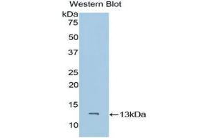 Western blot analysis of the recombinant protein. (CD59 anticorps  (AA 26-98))