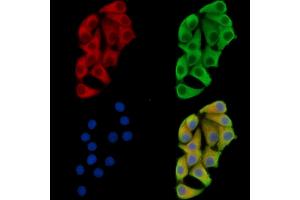 ABIN7096320 and ABIN7100382 staining Hela cells by IF/ICC.