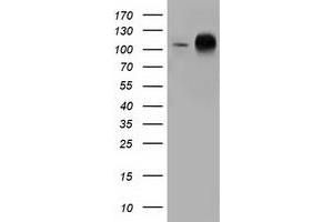 Western Blotting (WB) image for anti-Transforming, Acidic Coiled-Coil Containing Protein 3 (TACC3) antibody (ABIN1498100) (TACC3 anticorps)