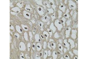 Immunohistochemistry of paraffin-embedded Human esophagus using IL33 Polyclonal Antibody (IL-33 anticorps)