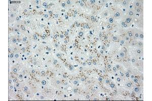 Immunohistochemical staining of paraffin-embedded Ovary tissue using anti-CHEK2mouse monoclonal antibody. (CHEK2 anticorps)