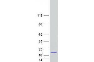 Validation with Western Blot