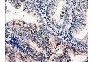 Image no. 1 for anti-Latexin (LXN) antibody (ABIN1499100)