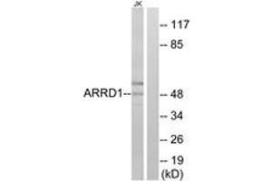 Western blot analysis of extracts from Jurkat cells, using ARRD1 Antibody. (ARRD1 anticorps  (AA 167-216))