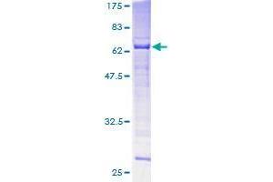 Image no. 1 for SPO11 Meiotic Protein Covalently Bound To DSB Homolog (SPO11) (AA 1-358) protein (GST tag) (ABIN1321209)
