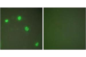 Immunofluorescence analysis of COS7 cells, using Ku70 antibody (ABIN5976448). (XRCC6 anticorps  (C-Term))